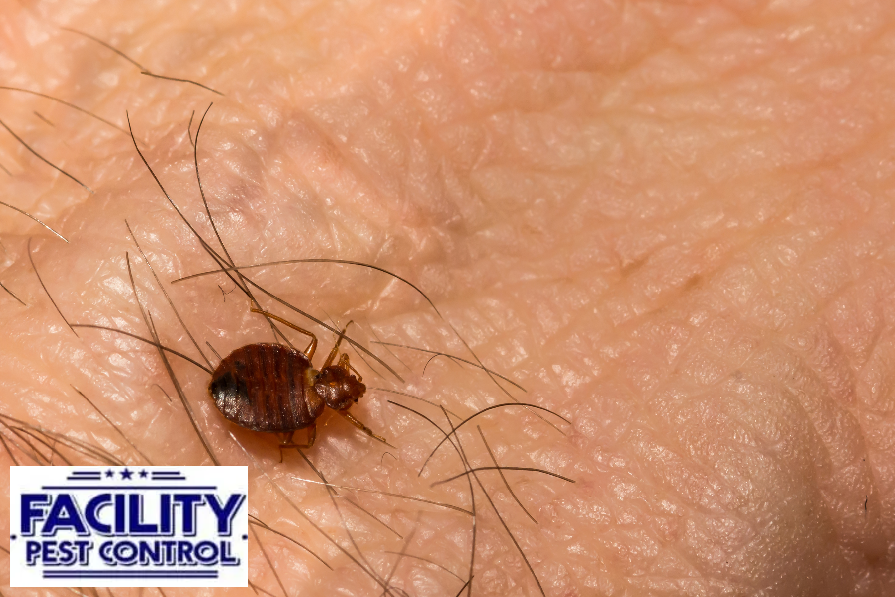 bed bug